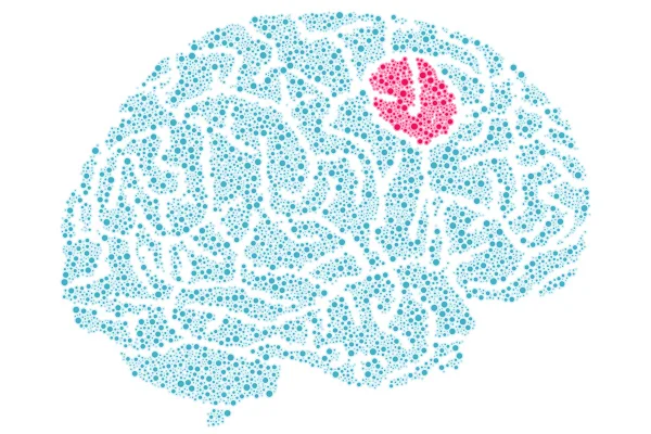 Novo teste promete fazer diagnóstico de tumor cerebral cair para duas horas
