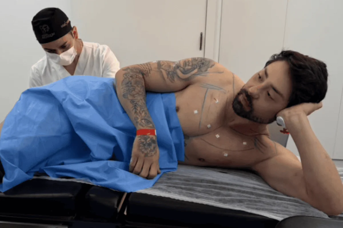"Cutox": médico explica procedimento anal realizado por Rico Melquiades