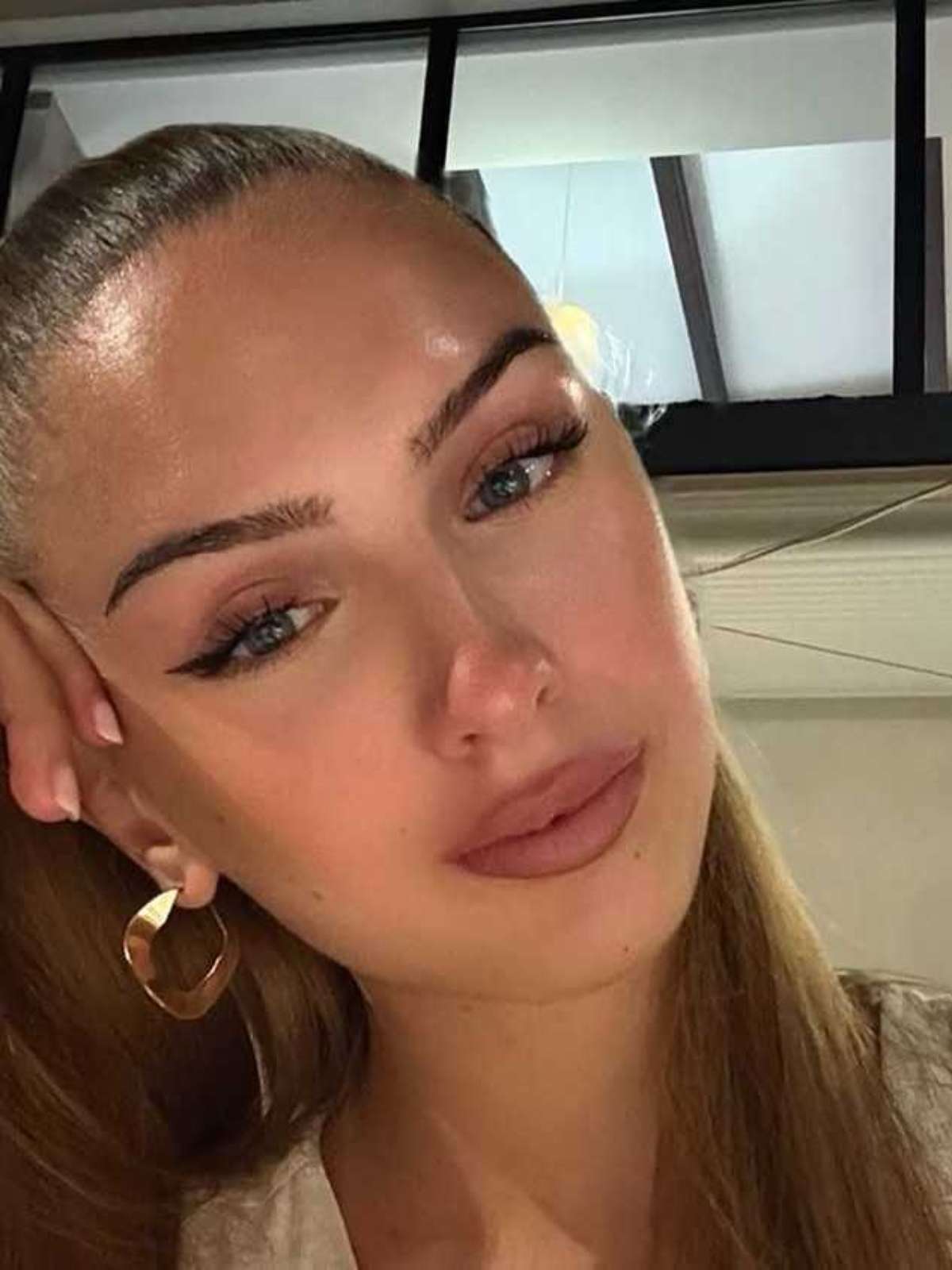 Miss Áustria morre aos 22 anos; modelo passou por 7 cirurgias cardíacas