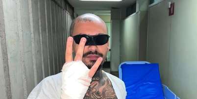 Streamer teve dedo amputado ao pular a grade do Rock in Rio. Foto: Reprodu&ccedil;&atilde;o/Instagram @lodk7777