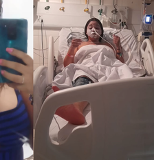 Andressiane Costa perdeu 95% da visão após crise alérgica e descobriu síndrome rara no Piauí Foto: Reprodução/Instagram:@ane_costa21